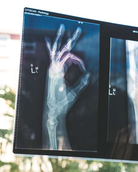 Radiographie